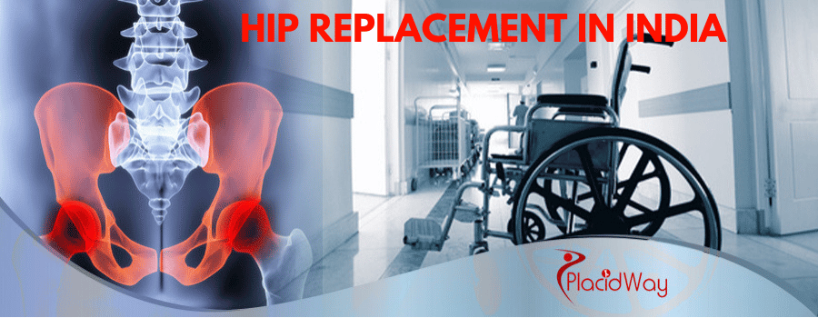 Hip Replacement in India